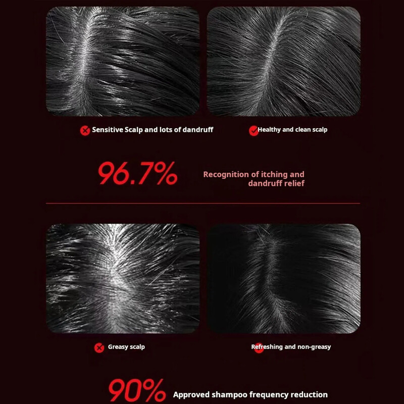 Scalp3 Galvas masāžas birste Matu galvas masāžas ierīce Bezvada elektriskā masieris galvas ādai Galvas masāžas birste matu augšanai