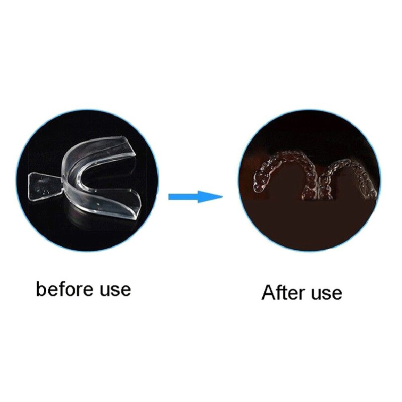 Štitnik za usta od 2/4 komada EVA štitnik za zube Noćni štitnik za usta za bruksizam, brušenje protiv hrkanja, izbjeljivanje zubi, zaštita od boksa