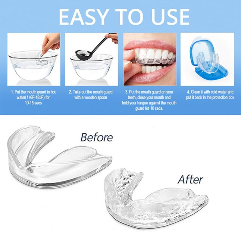 4 vnt. / rinkinys Silikoninis kandiklis nuo knarkimo breketai, apsaugantys nuo knarkimo.