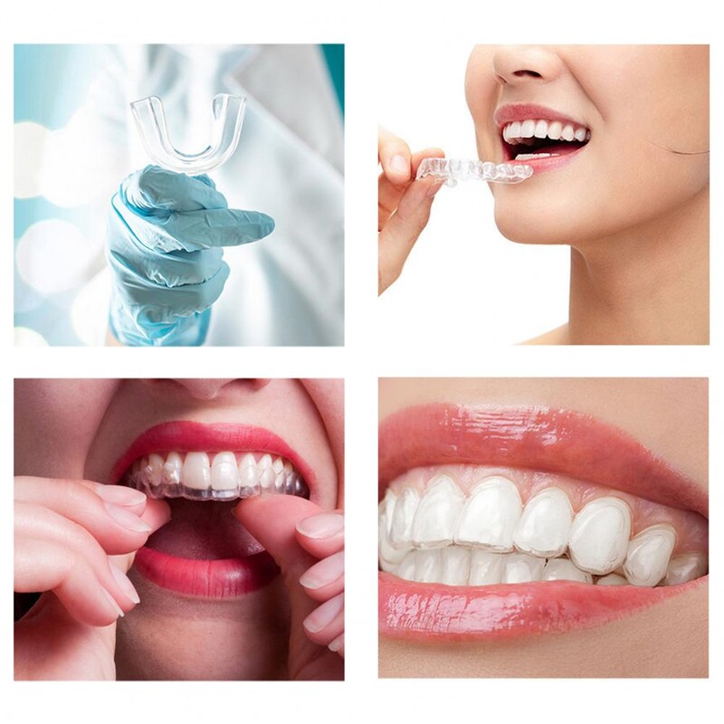 4 vnt. / rinkinys Silikoninis kandiklis nuo knarkimo breketai, apsaugantys nuo knarkimo.