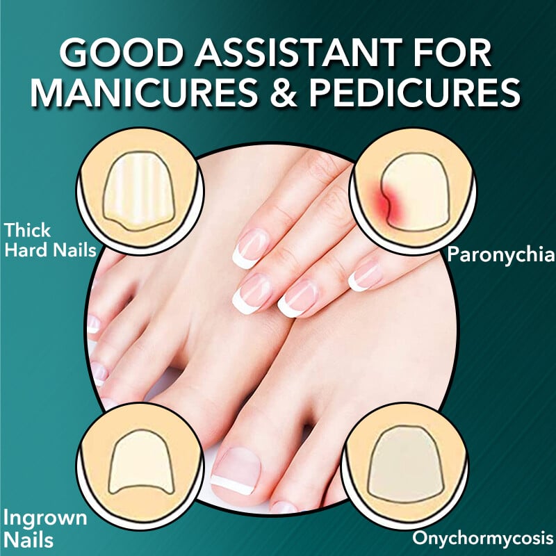 Dispozitive de tăiat unghii Foarfece mari pentru unghii Clește de vultur Clește de pedichiură pentru unghii cu incrustație pentru unghii Tasă de unghii cu gură de vultur