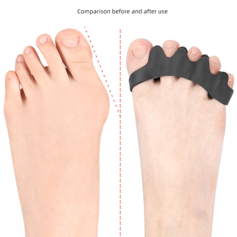 1 par Gel Hammer Ispravljač nožnih prstiju Silikonski separatori Korektor Razdjelnik Zaštitnik Valgus čukljev palca Podešivač za ublažavanje bolova u stopalima