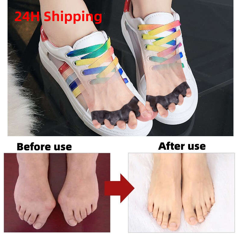 2Pcs=1Pair Black Orthopedic Product Silicone Separator Gel Protector Toe Bunion Corrector Foot Finger Iighter Pedicure