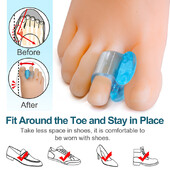 2gab zils mīksts silikona gēla purngalu atdalītājs pēdu kopšanas rīks Hallux Valgus Bunion Spacers īkšķu korektors