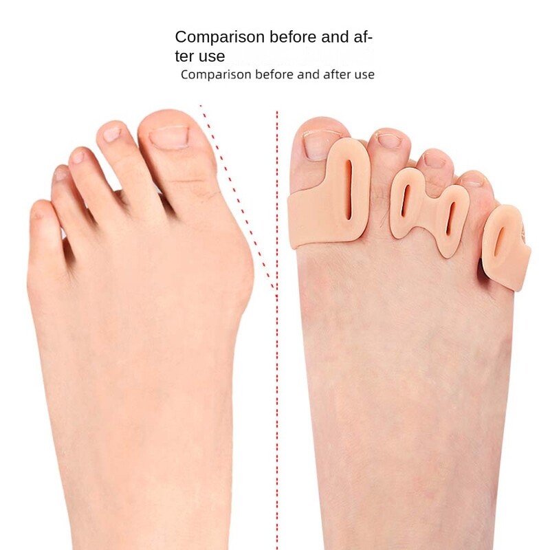 Bunion Protector Penkių skylučių pirštų tiesintuvas Pėdų priežiūros įrankiai Pėdų Valgus Korektorius Penkių skylučių pirštų skyrikliai Korektorius Nykštis