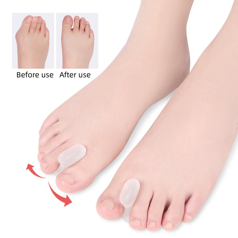1Pair Gel Separators Pėdų priežiūros įrankis Silikoniniai pirštai Hallux Valgus Bunion Protector Ortopedinė kojų pirštų korekcija pedikiūrui