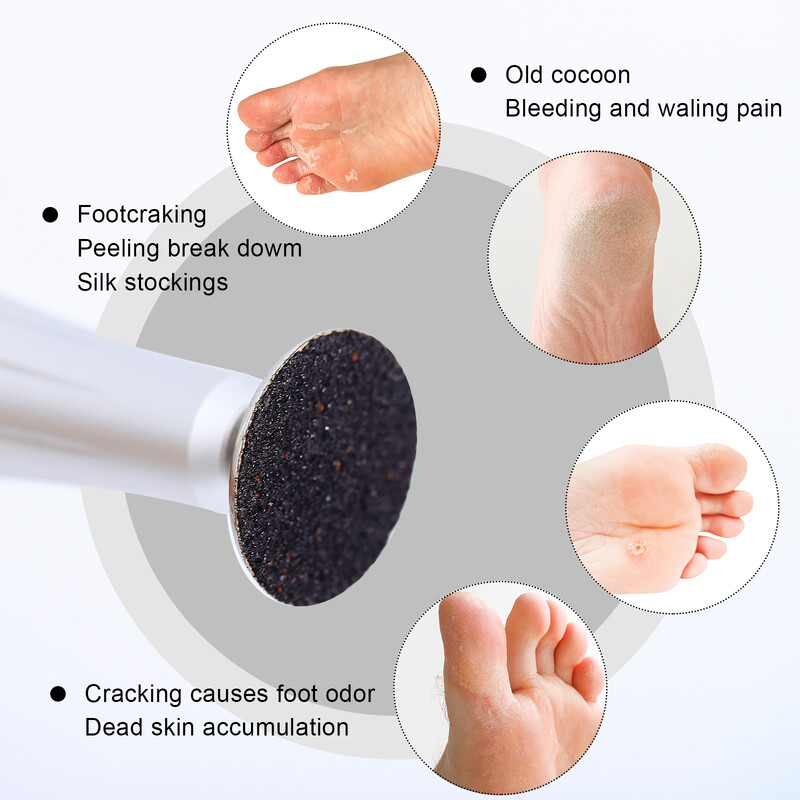 Foot Dead Skin Sandpaper Smart Wheel Pedicure Disc File Εργαλείο μανικιούρ Αντικαθιστώμενο γυαλόχαρτο για αφαίρεση κάλων 25mm