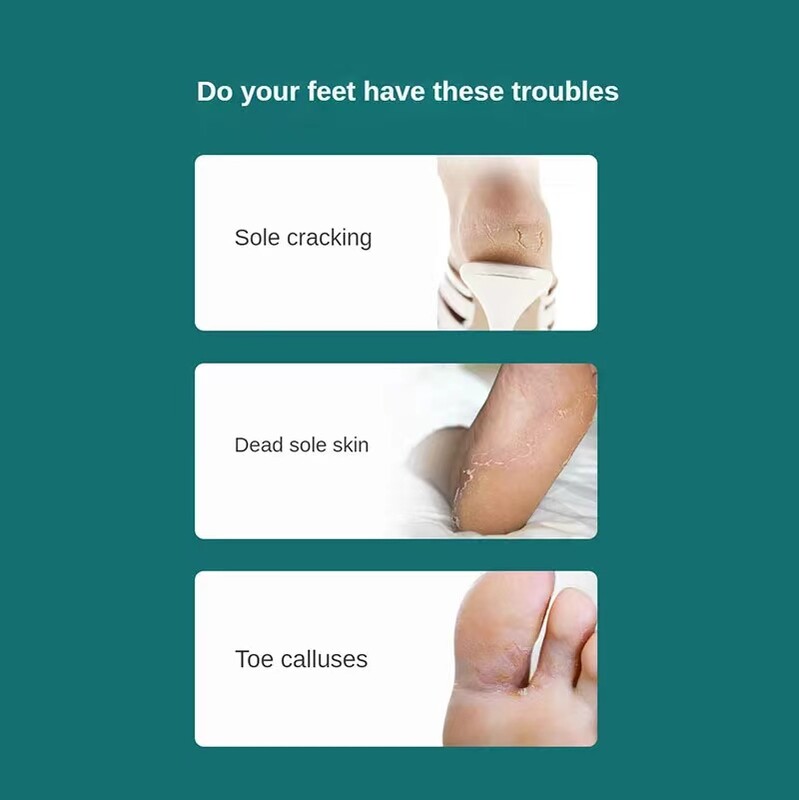 Manikiūro pedikiūro įrankiai Kojų nagų skustuvas Pėdų pedikiūro Peilio rinkinys Pėdų nuospaudos Rasp Files Dead Skin Remover Skraper Pėdų priežiūros įrankiai