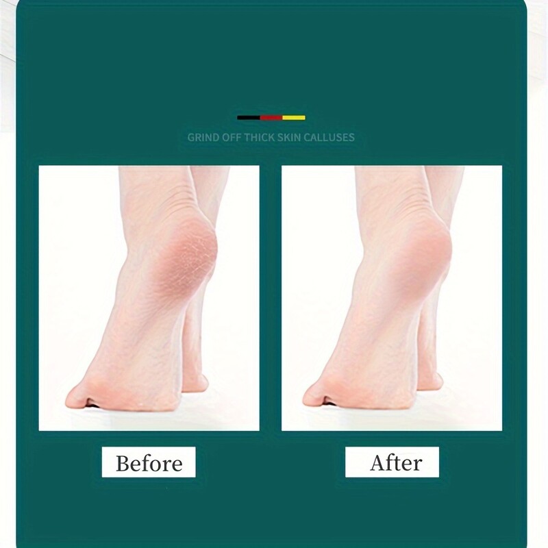 Visokokvalitetna turpija za stopala Dvostrano sredstvo za uklanjanje žuljeva za mrtvu kožu Profesionalni alati za pedikuru Strugalo za žuljeve Brusilica za pete