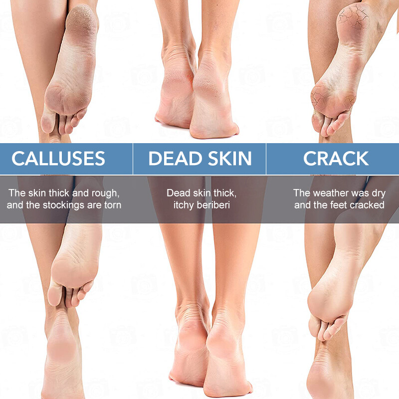 1 kom. Profesionalna nano staklena turpija za stopala za ženske pete Sredstvo za uklanjanje mrtve kože žuljeva stopala Proizvodi za njegu kože Pedikura