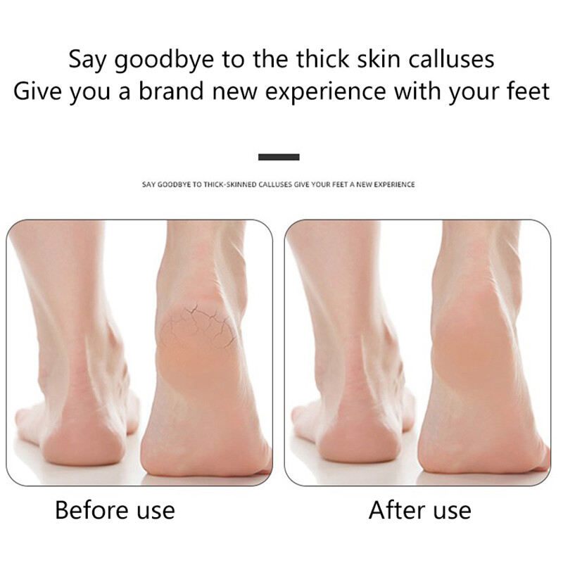 Piling za stopala Drška za pedikiranje PU Strugač za stopala Plovućac Turpija za stopala Mrtva tvrda Gruba suha koža Piling Sredstvo za uklanjanje žuljeva