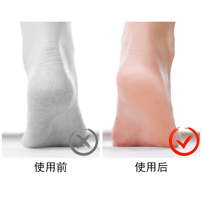 Φορητό γυάλινο λίμα ποδιών Κάλλος Ξύστρα φτέρνας Scrubber Αφαίρεση νεκρού δέρματος Επαναχρησιμοποιήσιμο buffer πεντικιούρ για απαλά λεία πόδια