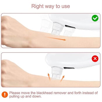 Средство за премахване на черни точки Прахосмукачка за почистване на пори Воден цикъл Вакуумно изсмукване на лицето Извличане на комедони Инструмент Грижа Супер микро балон НОВ LESEN