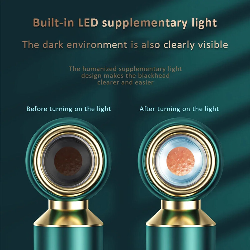 Αναβαθμισμένο Facial Pore Cleaner Ακμή Comedone Whitehead Extractor Κιτ αφαίρεσης μαύρων στιγμάτων Ηλεκτρική σκούπα για μαύρα στίγματα
