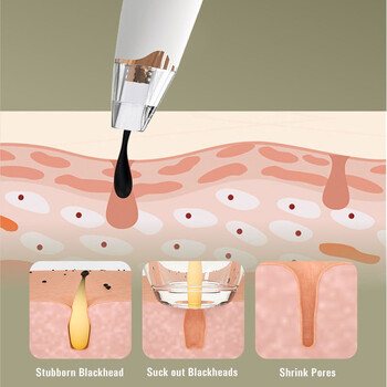 Препарат за премахване на черни точки Вакуум за почистване на порите Електрически нос Черно лице Микродермоабразио Машина за лице Красота Грижа за кожата