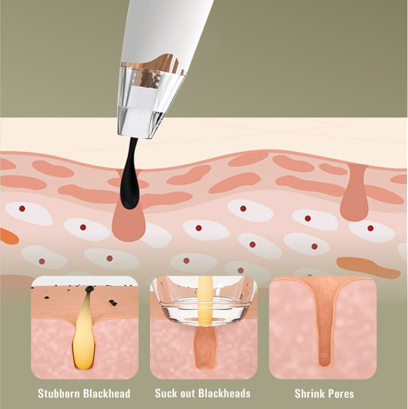 Mitesszer eltávolító porszívó pórustisztító elektromos orr fekete arc mikrodermoabráziós arcgép szépség bőrápolás