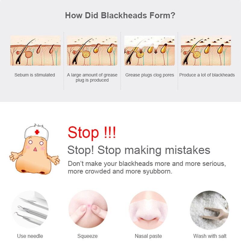 Mitesszer eltávolító porszívó pórustisztító elektromos orr fekete arc mikrodermoabráziós arcgép szépség bőrápolás