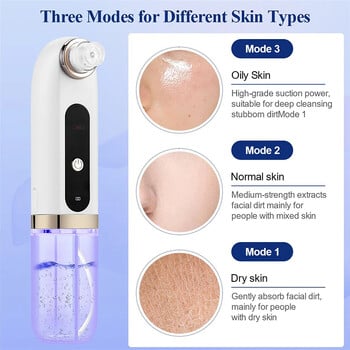 Ultra Micro Bubble Electric Remover Remover Suction Εργαλείο καθαρισμού προσώπου για νεκρό δέρμα ακμής αφαίρεση μαύρων κηλίδων για το πρόσωπο