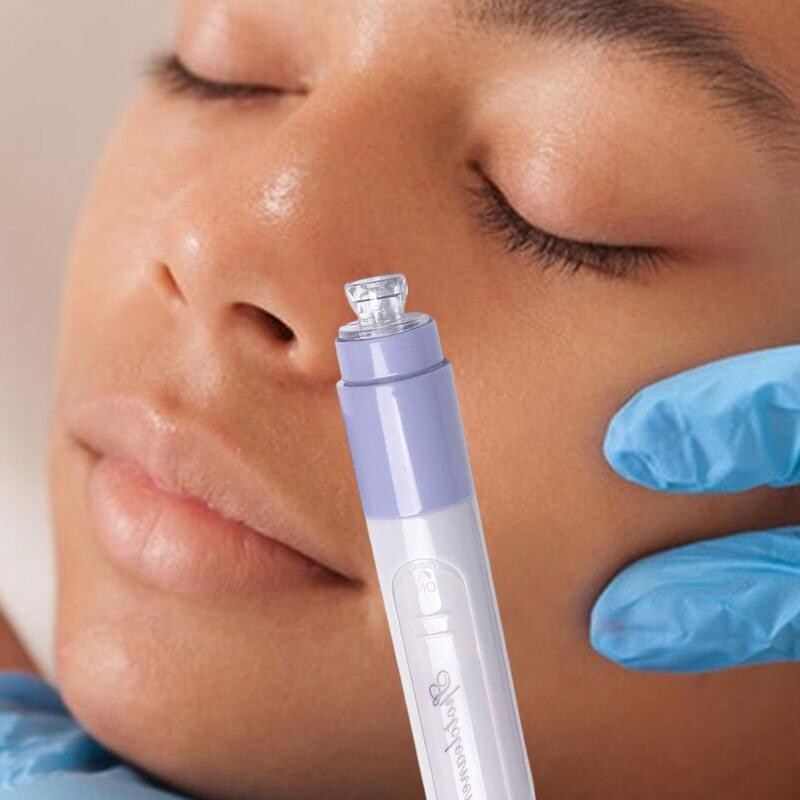 Εργαλεία καθαρισμού προσώπου με επαναφορτιζόμενο USB κύκλου νερού, ηλεκτρική σκούπα προσώπου, ηλεκτρικό σπυράκι αφαίρεσης μαύρου κεφαλιού