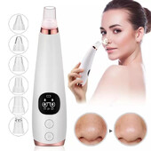 Electric Remover Blackhead Vacuum Cleaner ακμής Αφαίρεση μαύρων κηλίδων Facial Deep Cleansing Pore Cleaner Μηχανή Εργαλεία περιποίησης δέρματος