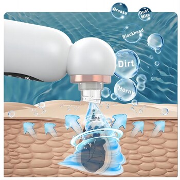 Ново средство за премахване на черни точки Вакуумно изсмукване Лична хигиена Малък балон Електрически почистващ препарат за лице и нос