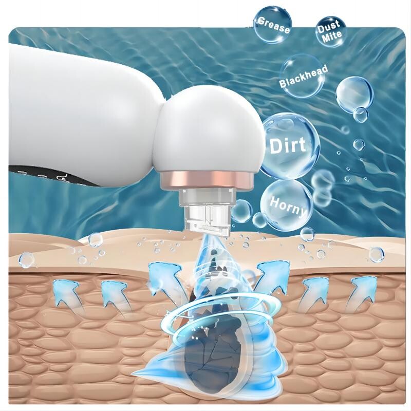Új mitesszer eltávolító vákuumszívó testápoló kis buborékos elektromos arc-orrtisztító