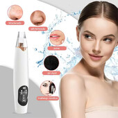 Υψηλής ποιότητας φορητό σπίτι μαύρων στιγμάτων αναρρόφησης σκούπα αφαίρεσης μαύρων στιγμάτων Skin Cleansing Beauty Instrument removeor de cravo