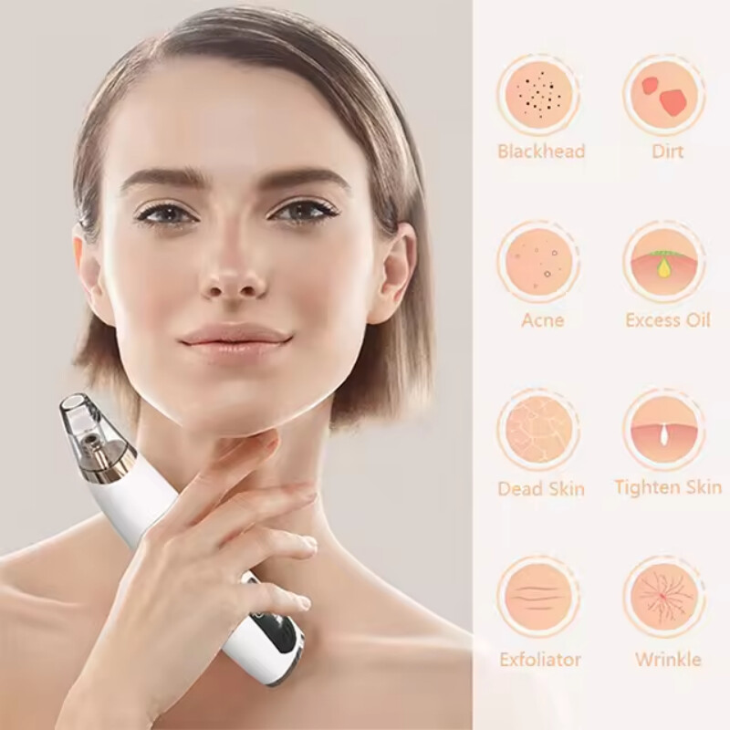 Υψηλής ποιότητας φορητό σπίτι μαύρων στιγμάτων αναρρόφησης σκούπα αφαίρεσης μαύρων στιγμάτων Skin Cleansing Beauty Instrument removeor de cravo