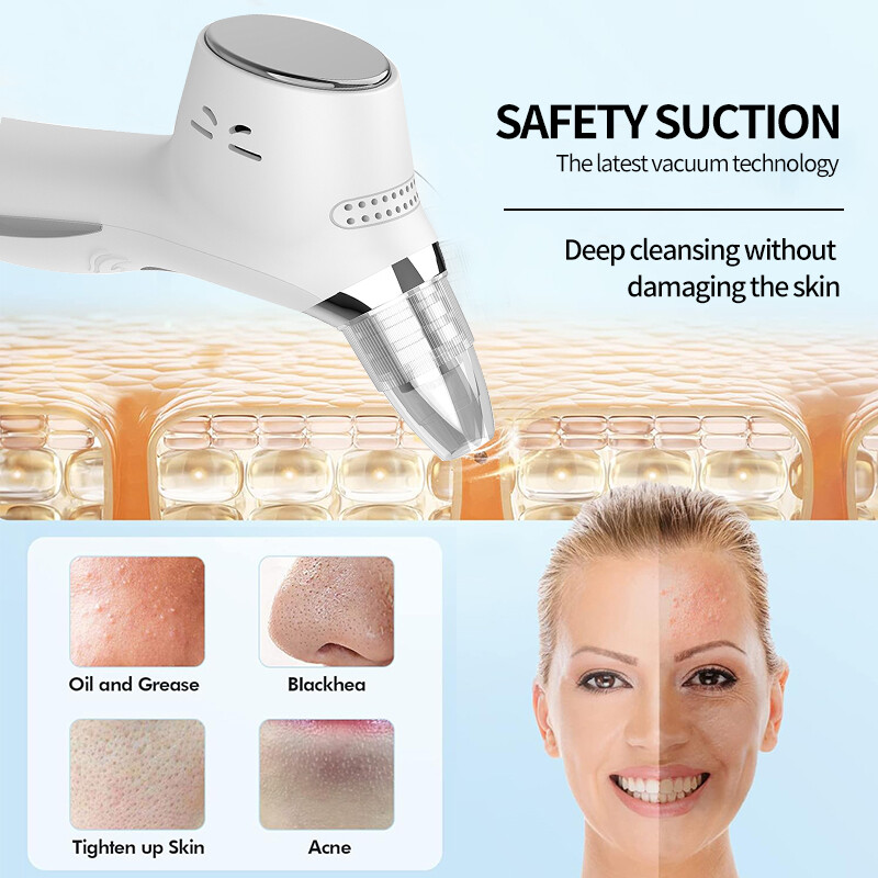 Πολυλειτουργικό προϊόν αφαίρεσης μαύρων στιγμάτων με κενό κραδασμούς κρύας και θερμής συμπίεσης, 5 αντικαταστάσιμοι αισθητήρες, 5 λειτουργίες, 5 επίπεδα αναρρόφησης, Τύπος C