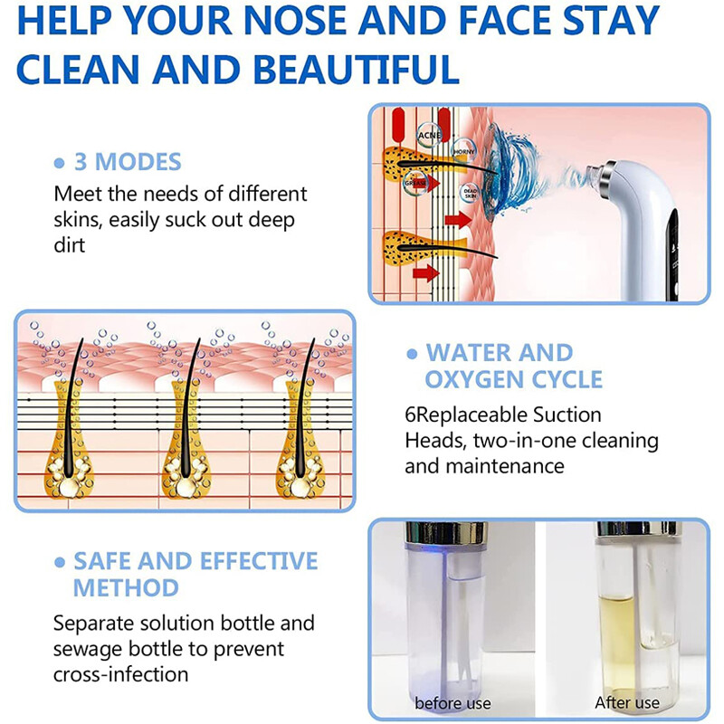 Elektromos kis buborékos mitesszer eltávolító USB vízciklusú pórus akne pattanás eltávolító vákuumszívó arc-orrtisztító eszköz