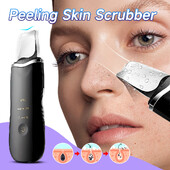 Elektrický čistič pleti, peeling, odstraňovač čiernych bodiek, hĺbkové čistenie tváre, zdvíhanie iónov, čistič pórov proti akné, špachtľa na tvár, lopatka na čistenie pleti