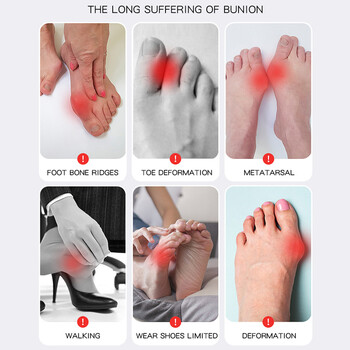 1 PC Big Toe Bunion Corrector Ρυθμιζόμενες ορθοπεδικές κάλτσες Διαχωριστής δακτύλων Pain Relief Hallux Valgus Feet Protector Foot Care Tools