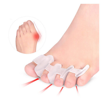 Σιλικόνη Gel Silicone Thumb Corrector Bunion Foot Toe Hallux Valgus Protector Separator Finger Straightener Adjuster Foot Care Tools