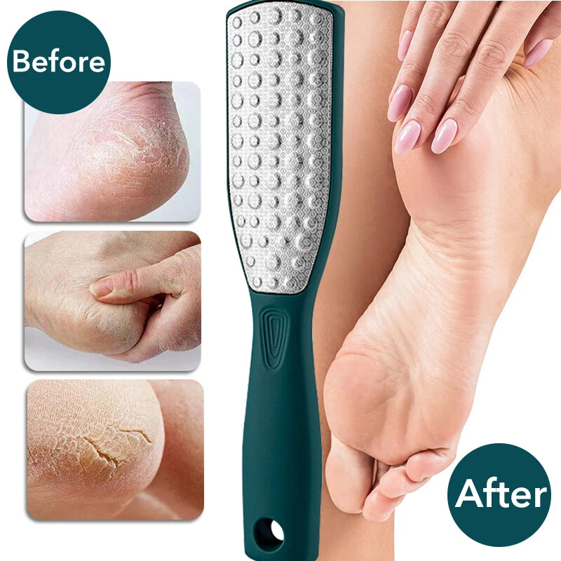 Profesionalna rašpica za stopala od nehrđajućeg čelika Ribelica za pete za stopala Sredstvo za uklanjanje žuljeva Sredstvo za uklanjanje grube mrtve kože Alat za njegu stopala