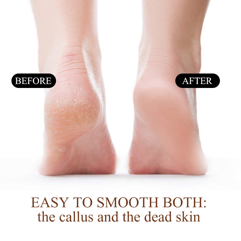 1 rinkinys dvipusis nerūdijančio plieno pedikiūro pėdų dildė + 10 vnt sauso šlifavimo popieriaus Daugkartinio naudojimo kietos odos valiklis pėdų priežiūros pedikiūro įrankiai