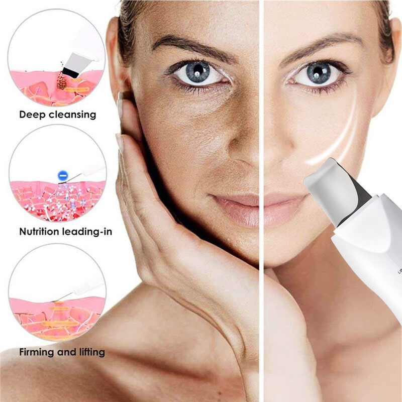 Veido vibracinis masažas odos šveitiklis jonų spuogų inkštirų valiklis šveitimo kastuvu valiklis Veido masažuoklis Odos priežiūra