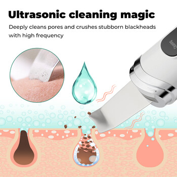 Ultrasonic Skin Scrubber Peeling Remover Blackhead Deep Face Cleaning Ultrasonic Ion Cleaner Pore Cleaner Facial Shovel Cleanser