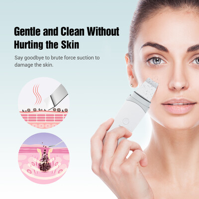 Ultrahangos bőrradír vibrációs mikroáramú mitesszer eltávolító arcradír lapát Clean Peeling arc lifting gép