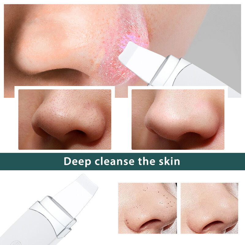 Ultrahangos bőrradír vibrációs mikroáramú mitesszer eltávolító arcradír lapát Clean Peeling arc lifting gép