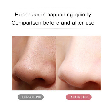 Ultrasonic Skin Scrubber Ance Pore Cleaner Peeling Deep Face Cleaning Deep Cleaning Προσώπου Ultrasonic Ion Facial Shovel Cleaner