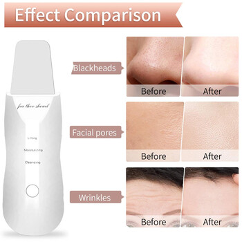 Electric Skin Scrubber Peeling Remover Blackhead Deep Face Cleaning Lifting Ion Acne Cleaner Pore Cleaner Σπάτουλα προσώπου Καθαριστικό φτυαριών