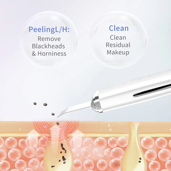 Electric Skin Scrubber Peeling Remover Blackhead Deep Face Cleaning Lifting Ion Acne Cleaner Pore Cleaner Σπάτουλα προσώπου Καθαριστικό φτυαριών