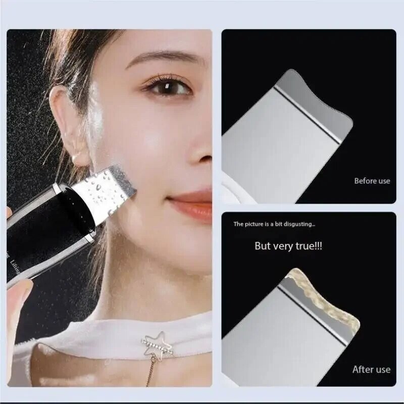 Mitesszer eltávolító Mitesszer tisztító pórusösszehúzó Beauty Device Dead Skin Akne Scalper arc pórustisztító