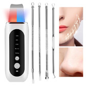 Ultragarsinis odos šveitiklis šveičiamasis inkštirų šalinimo kastuvas Clean Cavitation Peeling Cleanser Veido giluminio valymo mentele