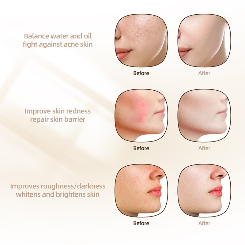 Силиконова светодиодна маска за лице 240 лампа Фотонна светлинна терапия Гъвкава мека маска против акне и против бръчки Силиконова маска за подмладяване на кожата