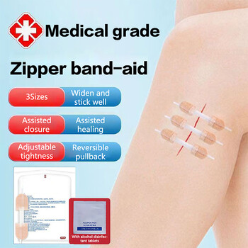 1 τεμ. Fast Suture Zipper Band-Aid Zipper Tie Επίθεμα κλεισίματος πληγών Αιμοστατικό έμπλαστρο πληγών εξωτερικού χώρου φορητό