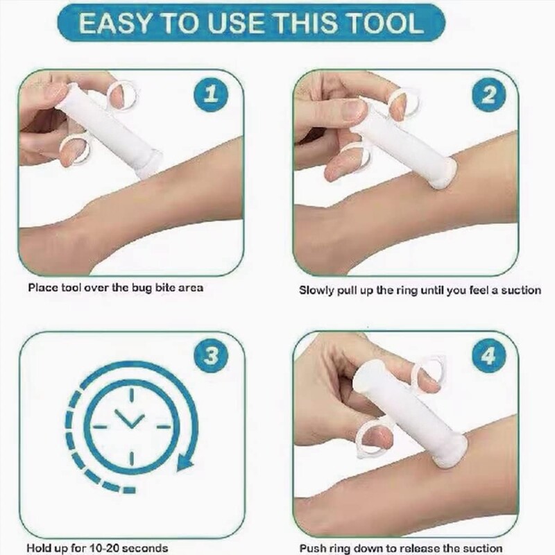 Instrument de aspirare - Mușcături de insecte și înțepături de albine/viespe Alinare naturală a mușcăturii de insecte Extractor nedureros de mușcături de insecte/venin pentru drumeții