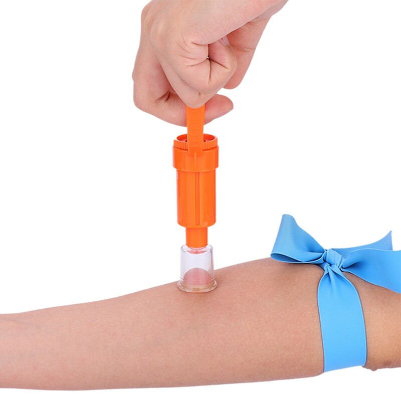 Lauko nuodų ištraukiklis nuodų gyvatės uodo bitės įkandimo vakuuminis siurblys išgyvenimui stovyklaujant žygiams pirmosios pagalbos saugos gelbėjimo įrankis