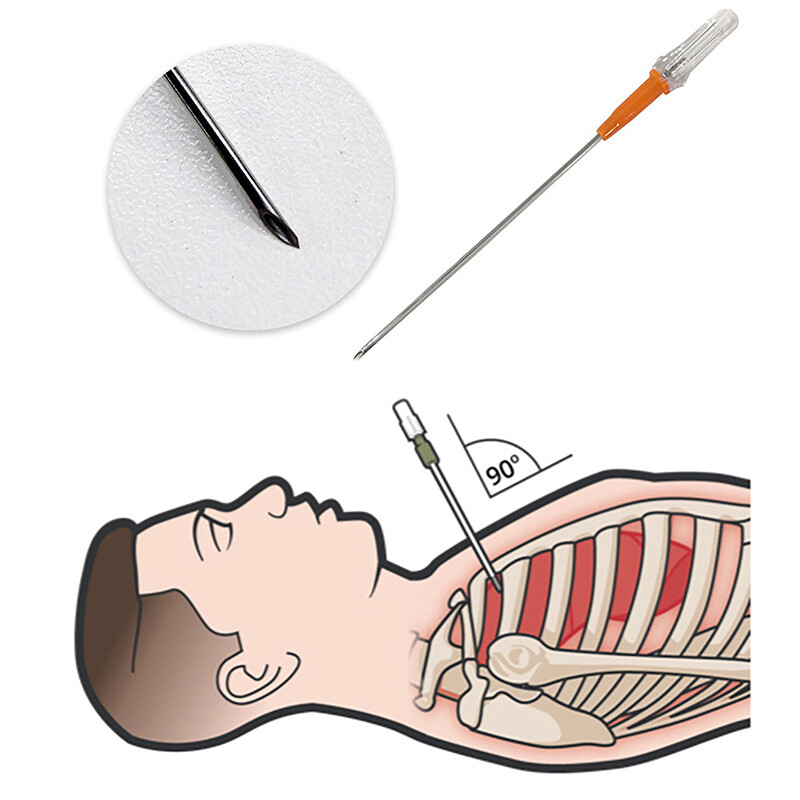 1 rinkinys greitosios pagalbos įrangos pirmosios pagalbos rinkinys įtempimo pneumotorakso krūtinės ląstos adata medicininė krūtinės ląstos dekompresinė adata