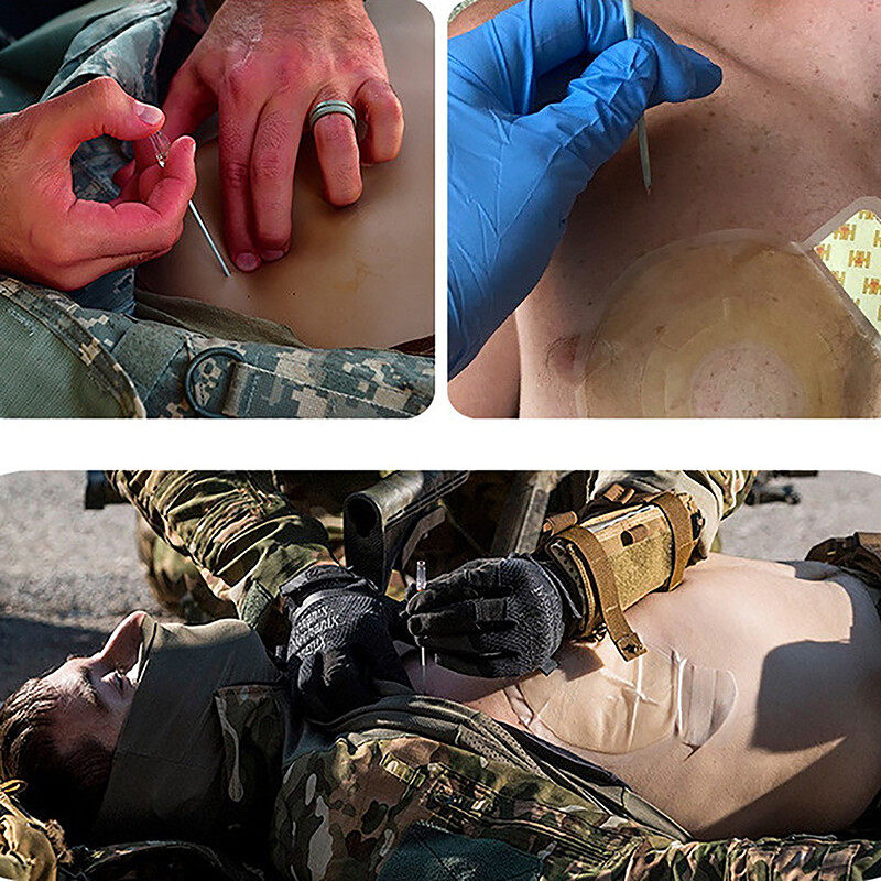 1 rinkinys greitosios pagalbos įrangos pirmosios pagalbos rinkinys įtempimo pneumotorakso krūtinės ląstos adata medicininė krūtinės ląstos dekompresinė adata